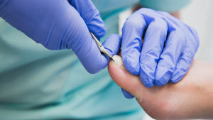 How To Fix Ingrown Toenail Permanently