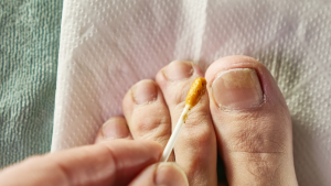 How to Get Rid of Toenail Fungus