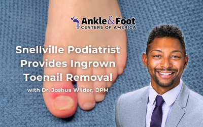 Snellville Podiatrist Provides Ingrown Toenail Removal