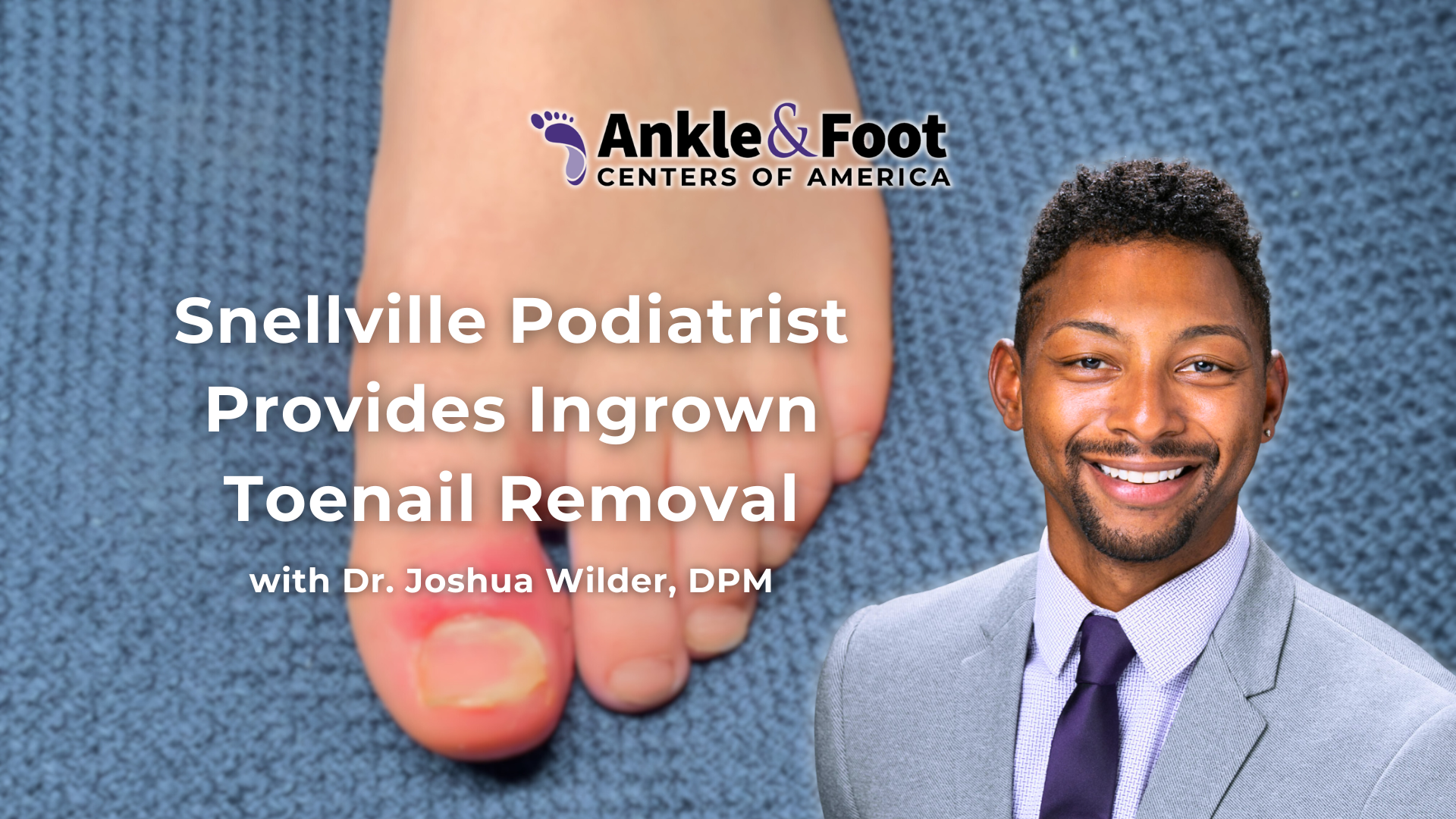 Ingrown Toenail Removal Snellville GA