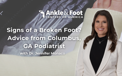 Signs of a Broken Foot? Advice from Columbus, GA Podiatrist.