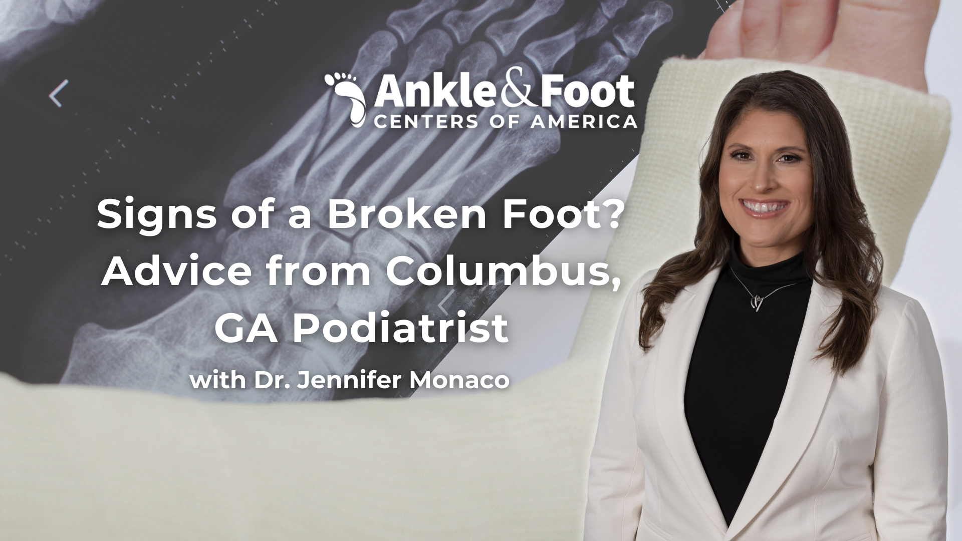 Broken Foot Specialist Columbus, GA