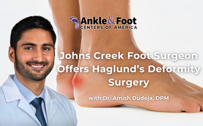 Johns Creek Foot Surgeon Offers Haglund’s Deformity Surgery