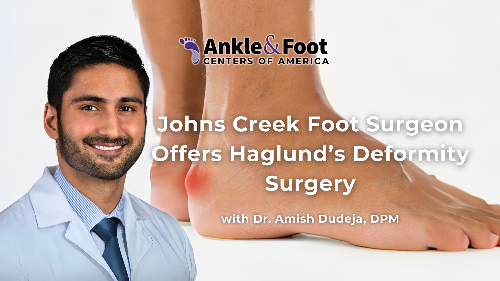 Haglunds Deformity Surgery Johns Creek