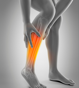 Medial Tibial Stress Syndrome Cause