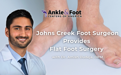 Johns Creek Foot Surgeon Provides Flat Foot Surgery