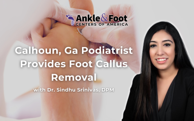 Calhoun Podiatrist Provides Foot Callus Removal