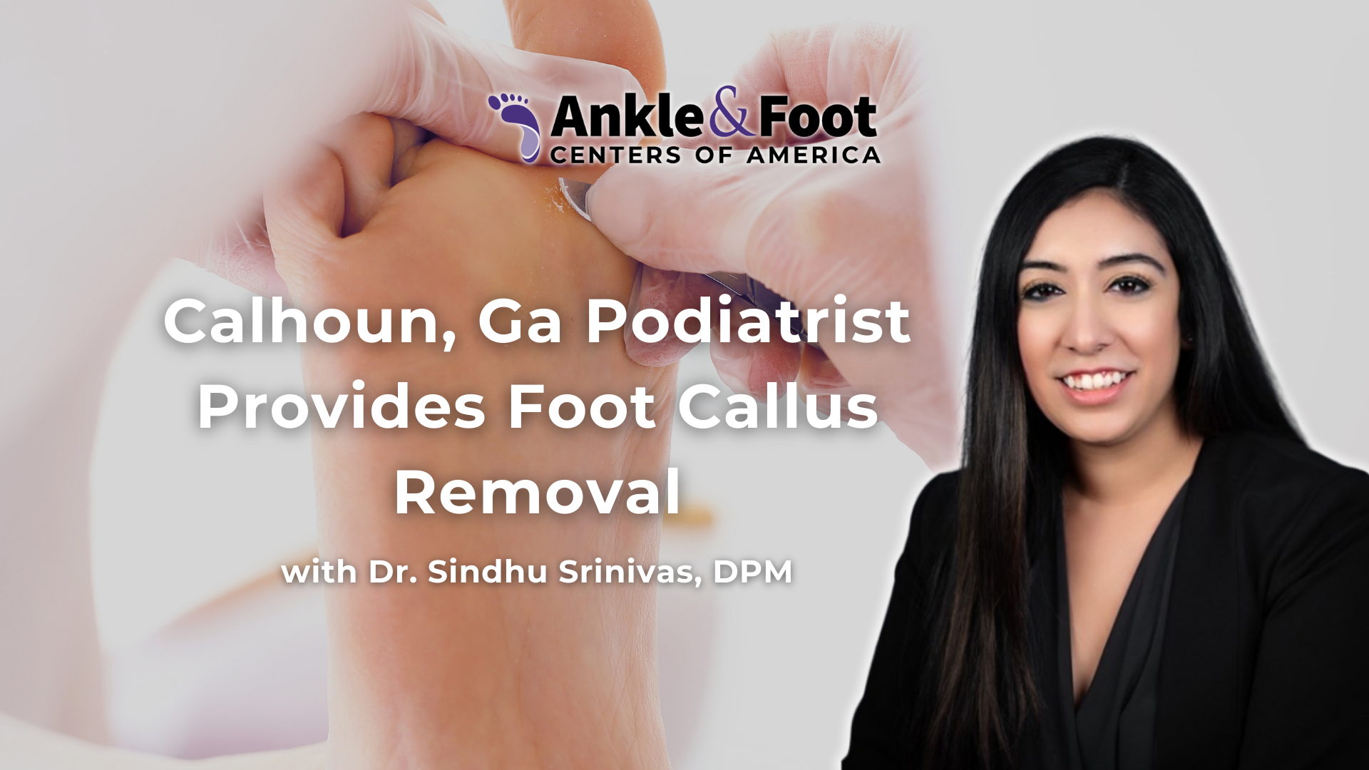 Foot Callus Removal Calhoun GA