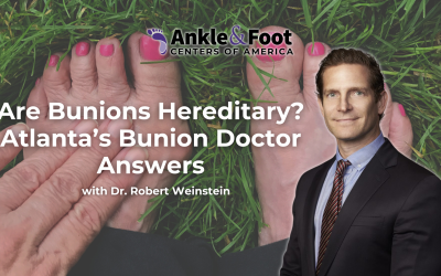 Are Bunions Hereditary? Atlanta’s Bunion Doctor Answers