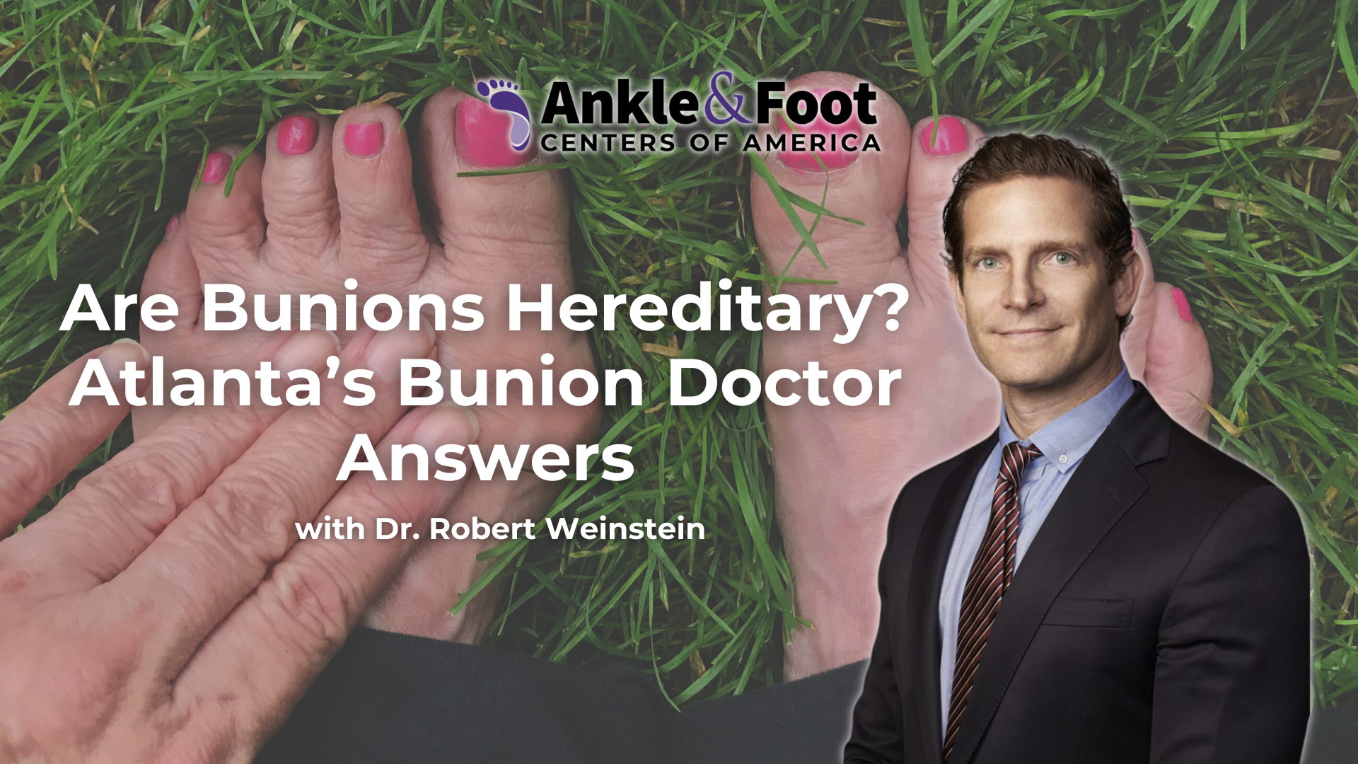 Bunion Doctor Atlanta