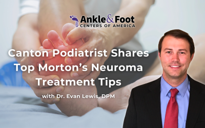 Canton Podiatrist Shares Top Morton’s Neuroma Treatment Tips