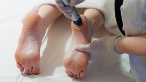 Laser Therapy For Plantar Fasciitis Near Me