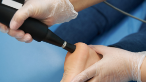 Laser Treatment For Plantar Fasciitis
