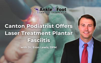 Canton Podiatrist Offers Laser Treatment Plantar Fasciitis