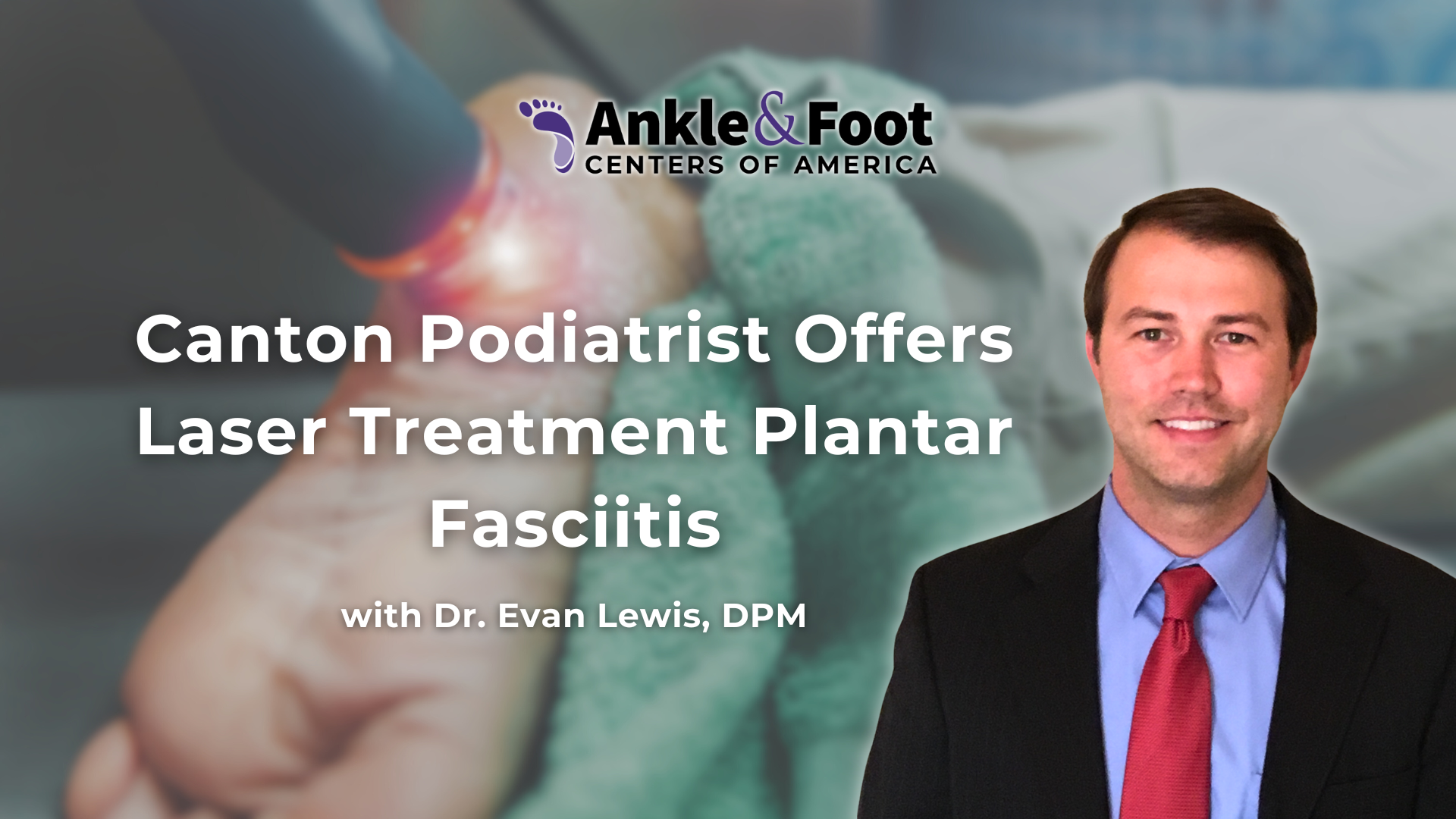 Laser Treatment Plantar Fasciitis Canton GA