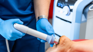 Plantar Fasciitis Laser Treatment