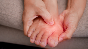 Bunion Symptoms