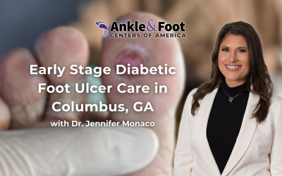 Early Stage Diabetic Foot Ulcer Care in Columbus, GA