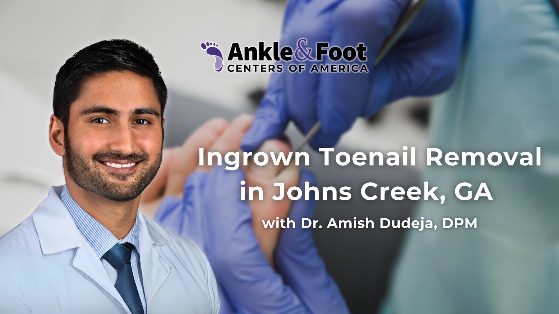 Ingrown Toenail Removal Johns Creek, GA