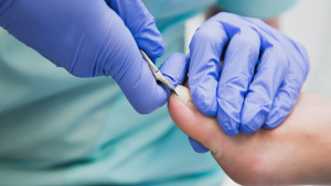 Ingrown Toenail Treatment