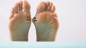 What Does A Bunion Look Like?
