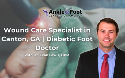 Wound Care Specialist in Canton, GA | Diabetic Foot Doctor