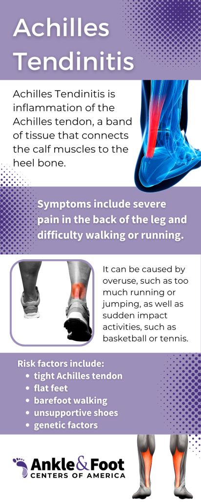 Achilles Tendinitis Exercises