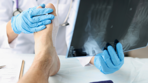 Acworth Foot Doctor