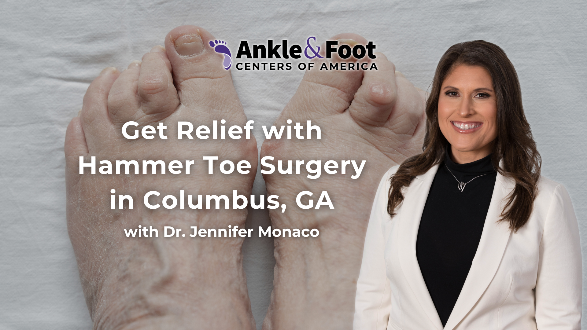 Hammertoe Surgery Columbus GA