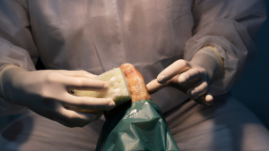 Surgery For Plantar Fasciitis