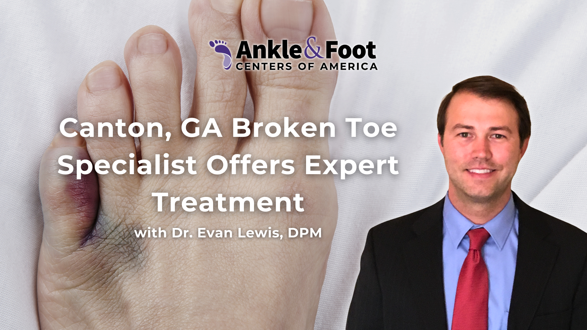 Broken Toe Specialist Canton, GA