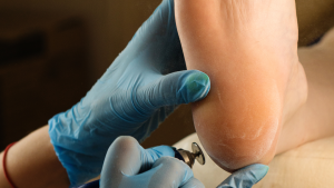 Buckhead Podiatrist
