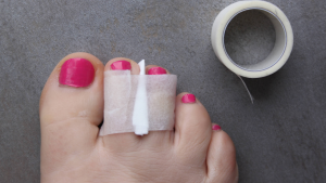 What To Do for a Broken Toe