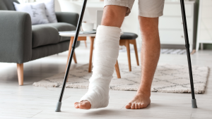 Broken Foot Recovery Time