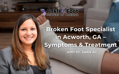 Broken Foot Specialist in Acworth, GA – Symptoms & Treatment
