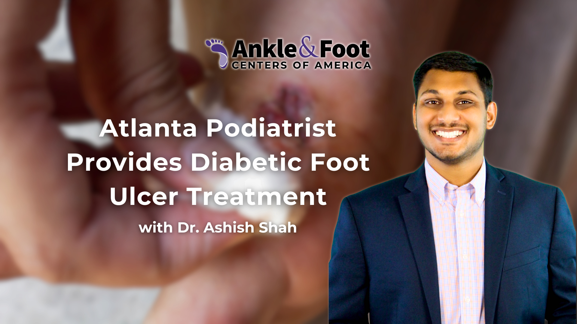Diabetic Foot Ulcer Treatment Atlanta