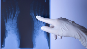 East Cobb Podiatry