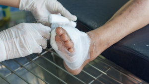 Foot Ulcer