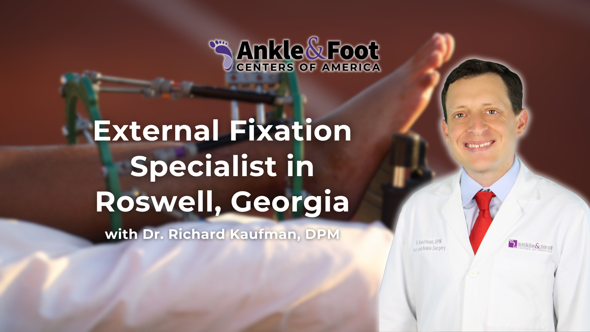 External Fixation Roswell GA