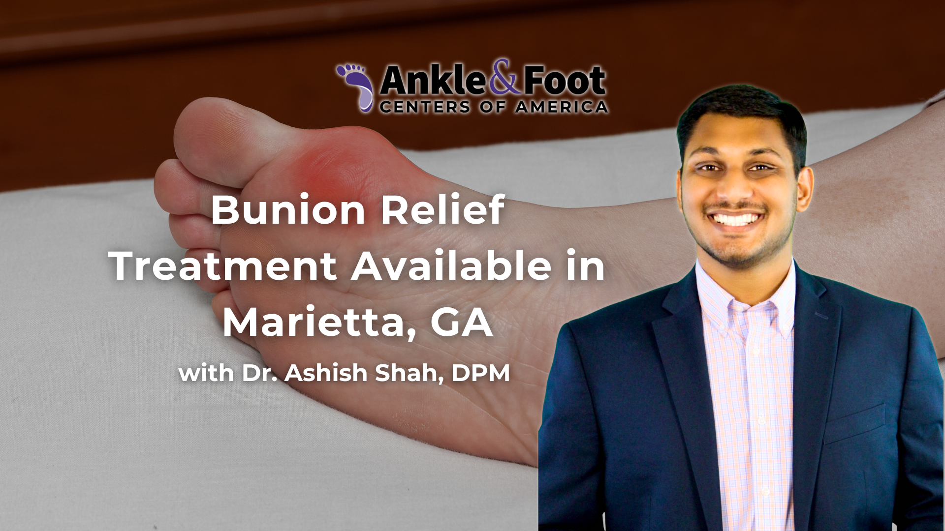 Bunion Relief Marietta GA