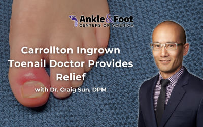 Carrollton Ingrown Toenail Doctor Provides Relief