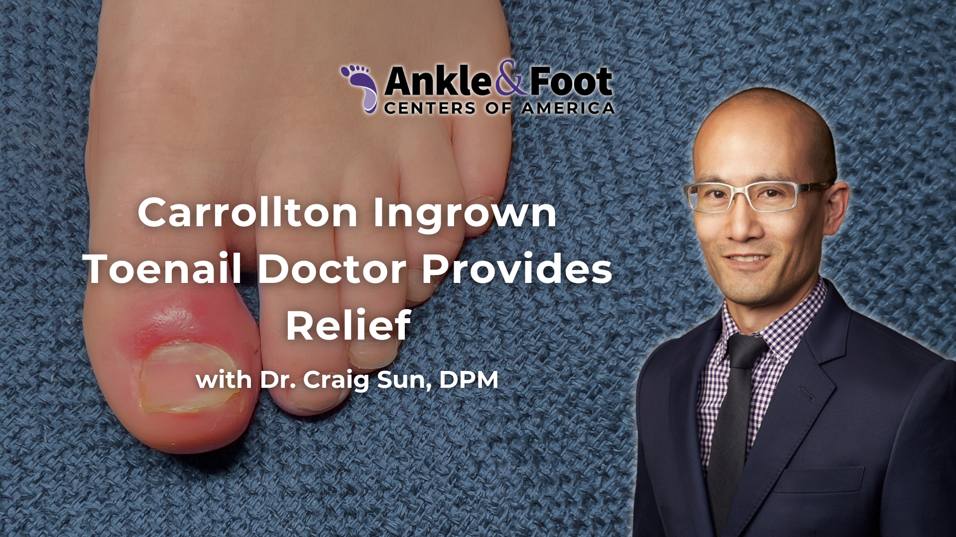 Carrollton Ingrown Toenail Doctor