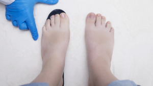 Non Surgical Treatment Options