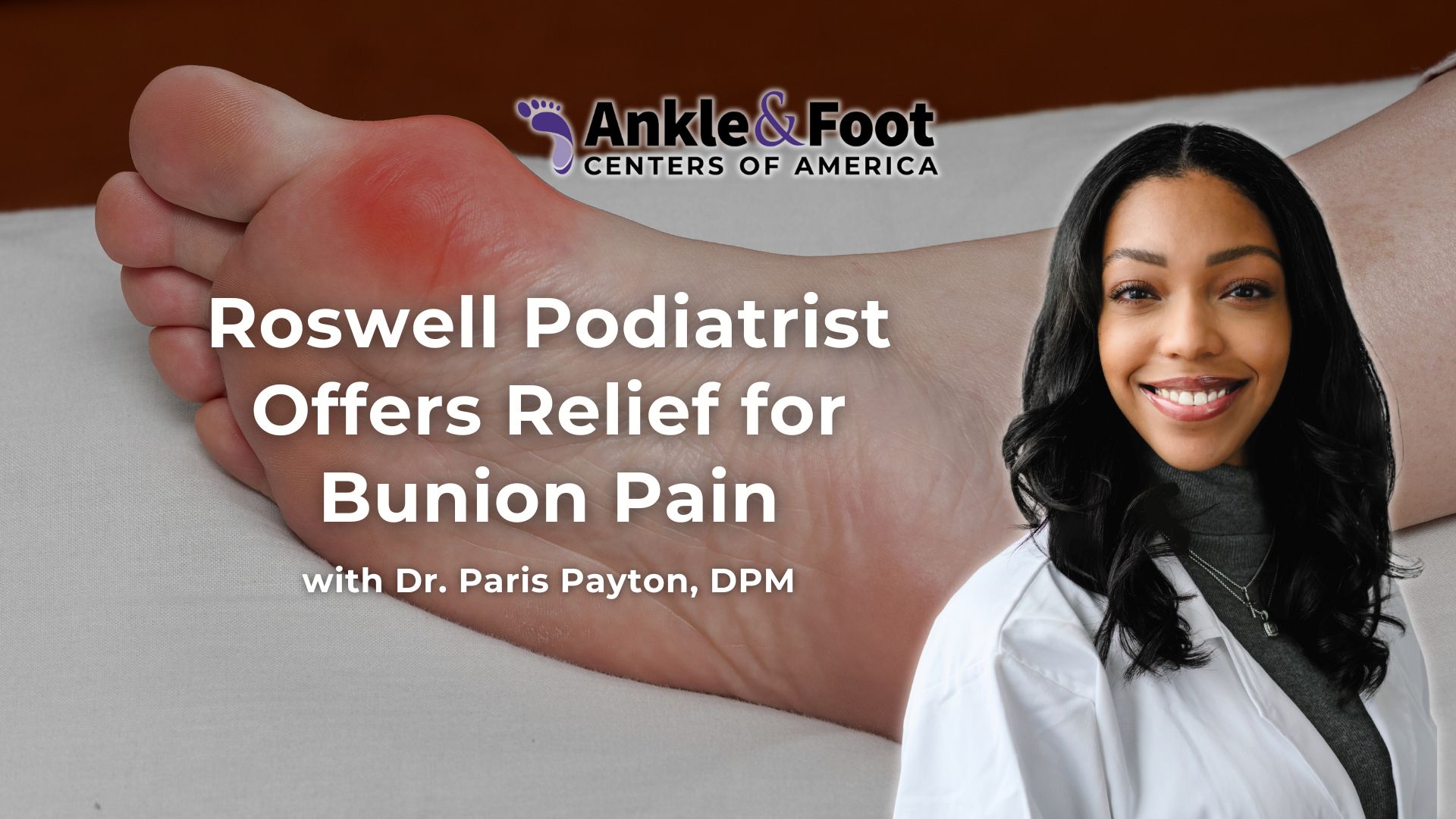 Bunion Pain Roswell GA Bunion Pain Roswell GA