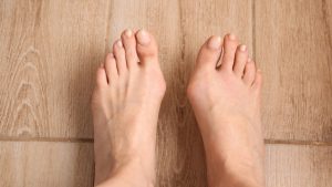 Bunion Risk Factors