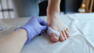 Bunion Treatment