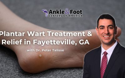 Plantar Wart Treatment & Relief in Fayetteville, GA