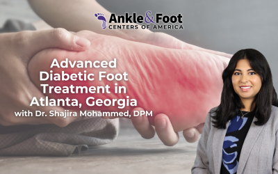 Advanced Diabetic Foot Treatment in Atlanta, Georgia