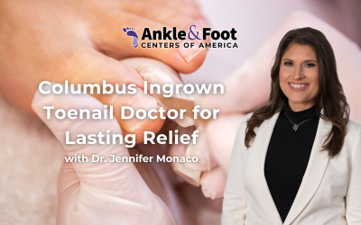 Columbus Ingrown Toenail Doctor for Lasting Relief