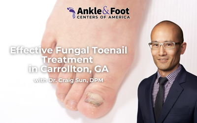 Effective Fungal Toenail Treatment in Carrollton, GA